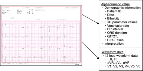 normal ecg report|How to Read and Report an Electrocardiogram .
